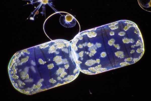 Microscopic view of dinoflagellates